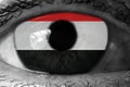 Yemen flag in the eye