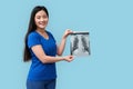 Young adult asian girl smiling, showing x-ray picture Royalty Free Stock Photo