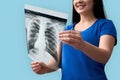 Young adult asian woman holding x-ray picture and smiling wide Royalty Free Stock Photo