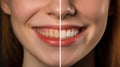 Young Adult Girl Showing Her Beautiful Before and After Teeth Whitening Smile - Generative AI