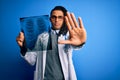 Young african american afro doctor man with dreadlocks holding chest lung xray with open hand doing stop sign with serious and