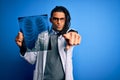 Young african american afro doctor man with dreadlocks holding chest lung xray pointing with finger to the camera and to you, hand Royalty Free Stock Photo