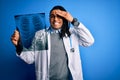 Young african american afro doctor man with dreadlocks holding chest lung xray stressed with hand on head, shocked with shame and