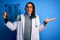 Young african american afro doctor man with dreadlocks holding chest lung xray very happy and excited, winner expression