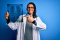 Young african american afro doctor man with dreadlocks holding chest lung xray very happy pointing with hand and finger Royalty Free Stock Photo