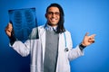 Young african american afro doctor man with dreadlocks holding chest lung xray very happy pointing with hand and finger to the Royalty Free Stock Photo