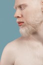 Young albino man with naked shoulders posing over turquoise studio background, closeup. Men beauty and skin care concept Royalty Free Stock Photo