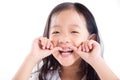 Girl child showing teeth with silver amalgam tooth sealant