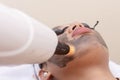 A young asian lady undergoes a laser carbon peel procedure at a skin or dermatologist clinic