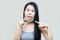 Young asian woman wearing medical face mask her hand point at pimple on chin,Skin allergy,acne from wearing a mask