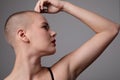 Young bald woman with unperfected skin, posing indoor. Skin care routine. Royalty Free Stock Photo