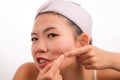 Young beautiful angry and upset Asian Chinese woman with acne pooping head of pimple with her fingers on the mirror cleansing the Royalty Free Stock Photo