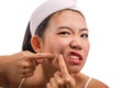 Young beautiful angry and upset Asian Chinese woman with acne pooping head of pimple with her fingers on the mirror cleansing the Royalty Free Stock Photo