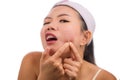 Young beautiful angry and upset Asian Korean woman with acne pooping head of pimple with her fingers on the mirror cleansing the Royalty Free Stock Photo