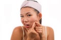 Young beautiful angry and upset Asian Korean woman with acne pooping head of pimple with her fingers on the mirror cleansing the Royalty Free Stock Photo