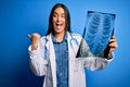 Young beautiful brunette doctor woman wearing stethoscope holding chest xray pointing and showing with thumb up to the side with Royalty Free Stock Photo