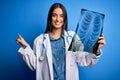 Young beautiful brunette doctor woman wearing stethoscope holding chest xray very happy pointing with hand and finger to the side Royalty Free Stock Photo