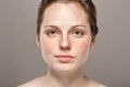 Young beautiful freckles woman face portrait with healthy skin Royalty Free Stock Photo
