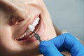 Young beautiful woman at the dental clinic at the doctorÃ¢â¬â¢s appointment