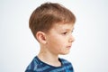 Young boy having chickenpox pictures of skin Royalty Free Stock Photo