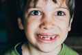 Young boy with missing teeth smiling Royalty Free Stock Photo