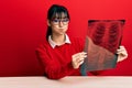 Young brunette woman with bangs holding chest radiography puffing cheeks with funny face