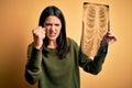 Young brunette woman with blue eyes holding xray of lungs over yellow background annoyed and frustrated shouting with anger, crazy