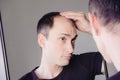 Young caucasian man looking at mirror worried about balding. Royalty Free Stock Photo