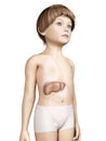 Young child - liver