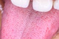 White teeth and pink gums while smiling red lips Royalty Free Stock Photo