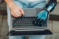 Young disabled man with artificial prosthetic hand using typing on laptop computer keyboard.