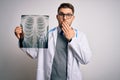 Young doctor man wearing medical coat looking at chest scan radiography over isolated background cover mouth with hand shocked Royalty Free Stock Photo