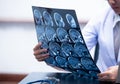 Young female doctor holding MRI or CT scan picture