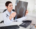 Young female doctor looking at X-ray Royalty Free Stock Photo