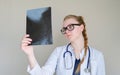 Young female doctor looking at x-ray of cervical spine, medicine concept Royalty Free Stock Photo