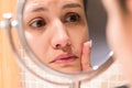 Young girl in front of a bathroom mirror putting cream on a red pimple. Beauty skincare and wellness morning concept Royalty Free Stock Photo