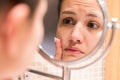 Young girl in front of a bathroom mirror putting cream on a red pimple. Beauty skincare and wellness morning concept Royalty Free Stock Photo