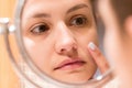 Young girl in front of a bathroom mirror putting cream on a red pimple. Beauty skincare and wellness morning concept Royalty Free Stock Photo