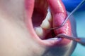 Young girl having dental check up Royalty Free Stock Photo