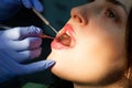 Young girl having dental check up Royalty Free Stock Photo