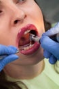 Young girl having dental check up Royalty Free Stock Photo