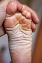 Young girl`s toes are healthy and beautiful.