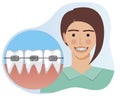 Young girl smiles with braces on teeth as a concept of orthodontic services, flat vector stock illustration with woman and braces