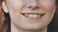 A young girl smiles and shows her crooked teeth.