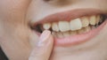 A young girl smiles and shows her crooked teeth.