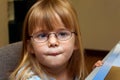 Young Girl With Strabismus or Ocular Palsy Trying On A Pair Of N