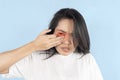 Young girl suffering from eyes pain and feeling something in eye, posing on blue wall. Cause of pain include contact lens problem Royalty Free Stock Photo