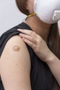 A young girl 18-20 years old in a medical mask points to a bandage with a vaccine against COVID-19, a coronavirus vaccination prog Royalty Free Stock Photo