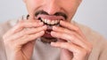 Young man adjusting and placing invisible silicone aligner for dental correction