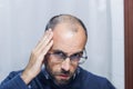 Young man with alopecia looking at his head and hair in the mirror Royalty Free Stock Photo